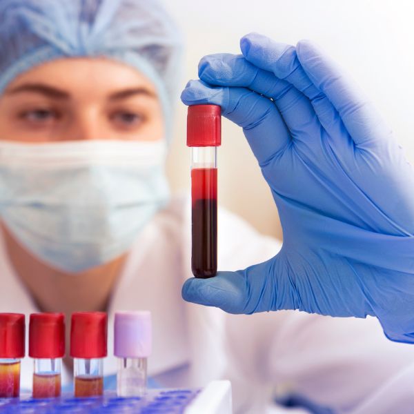 BLOOD TEST - BREF, Biomedical Research & Educational Foundation (BREF)